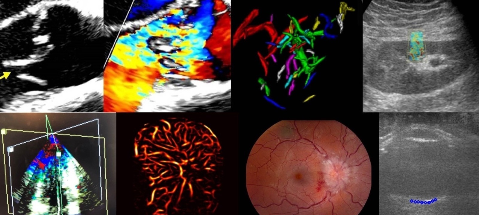 Ultrasound Research Center Hybrid Symposium