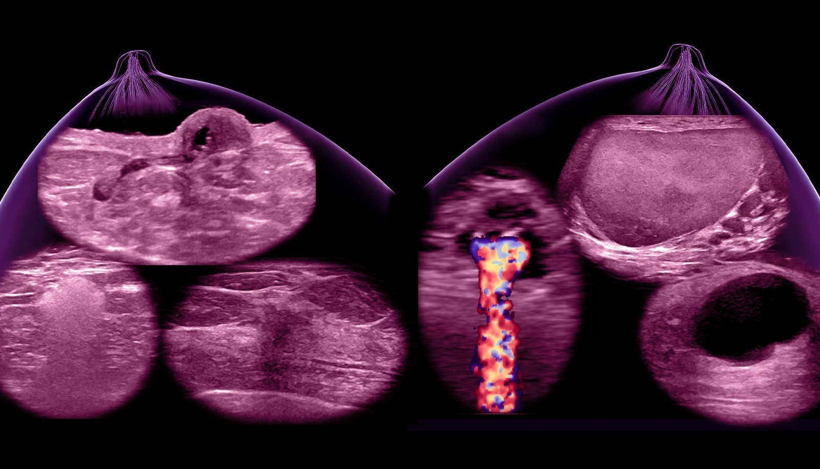 Breast Ultrasound Knobology